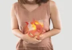 Cara Mengatasi Asam Lambung