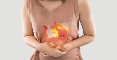 Cara Mengatasi Asam Lambung